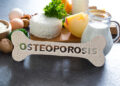Osteoporosis, 8 Ways to Lower Your Risk
