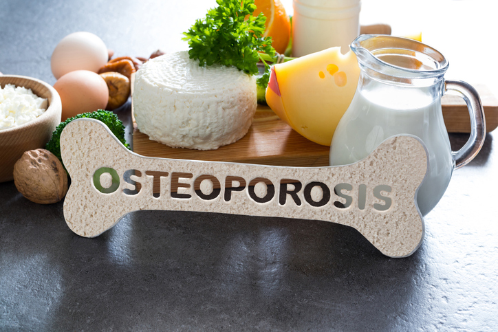 Bone-shaped cutout with the word Osteoporosis surrounded by dairy products, eggs, nuts, and cheese on a dark surface.